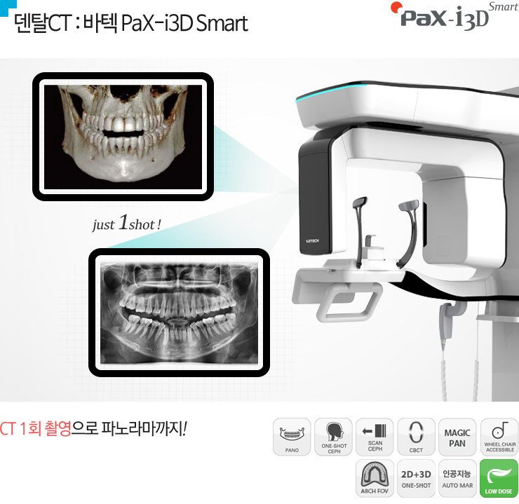 ŻCT :  PaX-i3D Smart